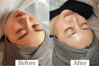 潤い艶肌／肌質改善 YUKAのエステ・リラクイメージ