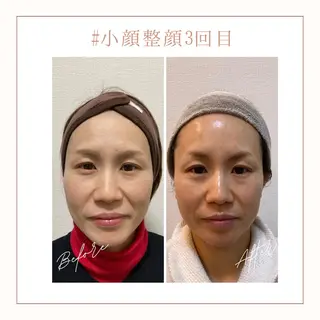 小顔×肌質改善サロン soin〔ソワン〕のエステ・リラクイメージ