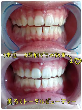 メンズ 美ろく　トータルビューティーサロン所属・セルフホワイトニング メーカー直営サロンのエステ・リラクイメージ