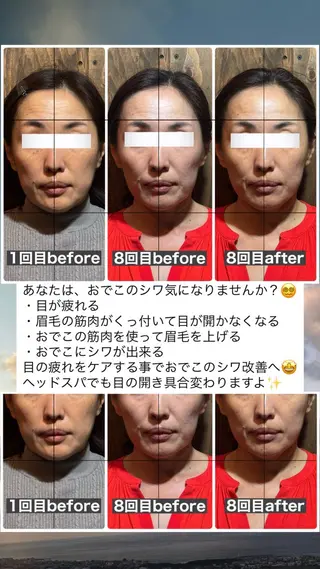 💎後悔させない小顔 矯正💎イトヤマ🌱のエステ・リラクイメージ