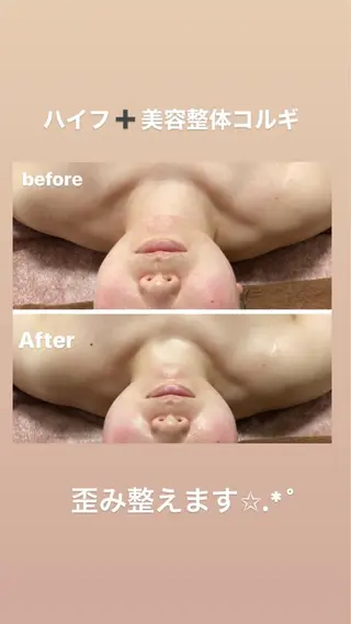 美顔秘密基地新宮所属・美顔秘密基地 新宮のその他イメージ