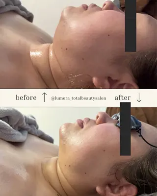 TOTAL BEAUTYSALON LUMORA所属・LUMORA🌟 トータルビューティーのエステ・リラクイメージ