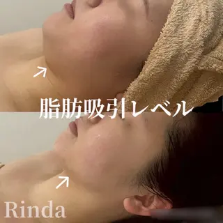 ブライダル痩身×脱毛 尼崎駅前サロンのエステ・リラクイメージ