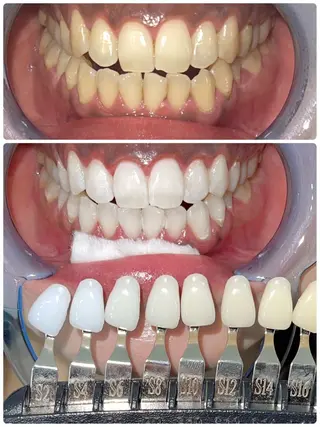 ホワイトニング/脱毛 専門店エクシア岡崎店のその他イメージ