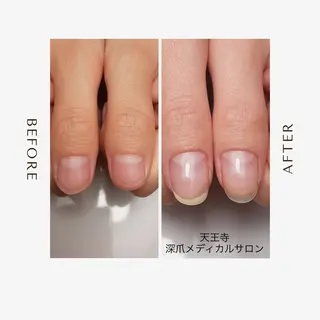 ネイル 天王寺 深爪メディカルサロンのネイルデザイン