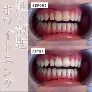 ecxia  white 　広島袋町店所属・セルフホワイトニング エクシア広島袋町店のその他イメージ