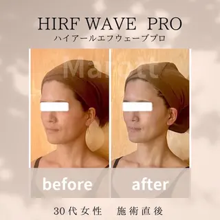 小顔サロン Marottのエステ・リラクイメージ