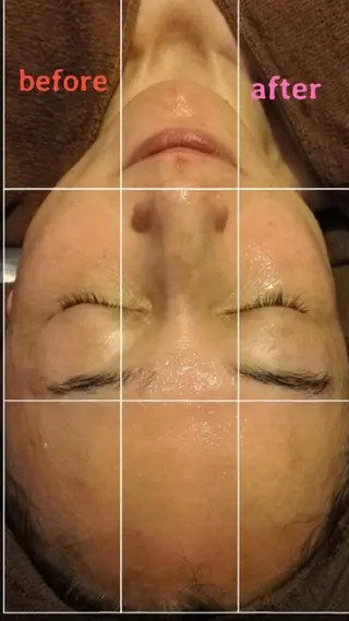 肌管理専門！BACI 加盟店LUANAのエステ・リラクイメージ