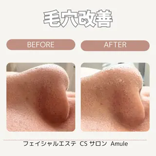 CSサロン Amule所属・Amule anna🦋のエステ・リラクイメージ