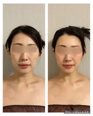 SOLUNA目黒店所属・小顔/毛穴洗浄/痩身 ayako🌿のエステ・リラクイメージ