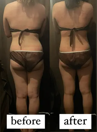 痩身・フェイシャル/if  byOrabriller所属・if byOrab riller【ｲﾌ】のその他イメージ