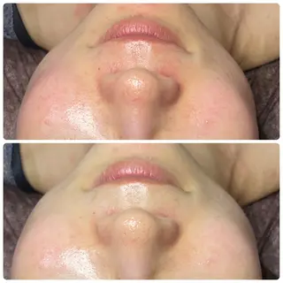 肌育脱毛サロン LikoLinaのその他イメージ