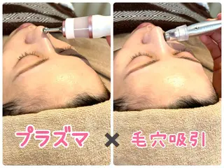 salon A.glansh所属・肌質改善salon♪ 効果がわかる♪南森町のネイルデザイン