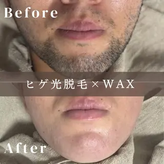 メンズ 《脱毛/韓国肌管理サロン》Epina -エピナ- 横浜店所属・脱毛/韓国肌管理 Epina 横浜店のその他イメージ