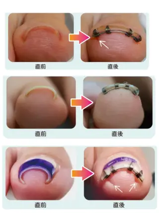 ネイル CROWN プライベートサロンのネイルデザイン