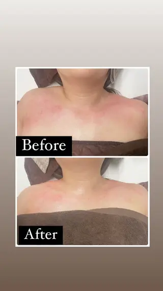 Le Cherien所属・姫路/肌管理/脱毛 Le Cherienのその他イメージ