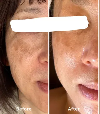 自宅salon🌿 kukunaのエステ・リラクイメージ