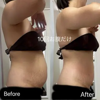 痩身&小顔サロン L i l yA sのエステ・リラクイメージ