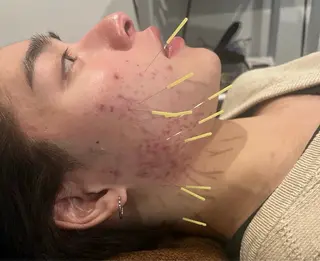 メンズ 美容鍼灸サロン LOMIHARIのエステ・リラクイメージ