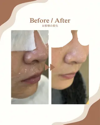 デ・アイム京橋所属・長谷川 華音のエステ・リラクイメージ