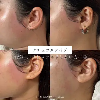 HOTEL&PARK Mikuワックス脱毛のエステ・リラクイメージ