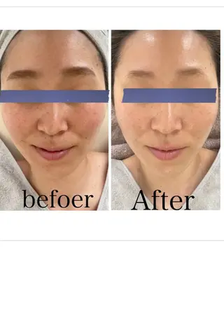 エイジングケア専門店 richbelle所属・エイジングケア専門 richbelleのエステ・リラクイメージ