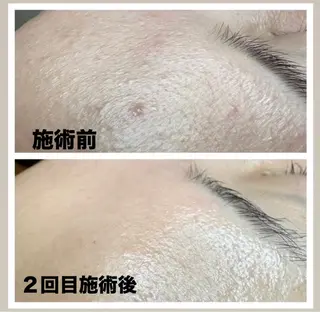 スリーエスプラス内　美肌サロンEme所属・希映 -kieのエステ・リラクイメージ