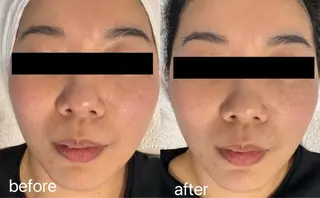 メンズ Queen Salonのエステ・リラクイメージ