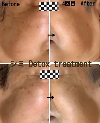 ヴィーナス ビューティーのエステ・リラクイメージ