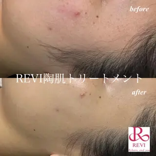 癒しサロンAnone.所属・小林 純奈のエステ・リラクイメージ