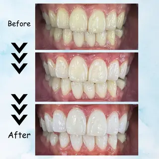 カラー セルフホワイトニング エクシア塩釜口駅前店所属・セルフホワイトニング エクシア塩釜口駅前店のその他イメージ