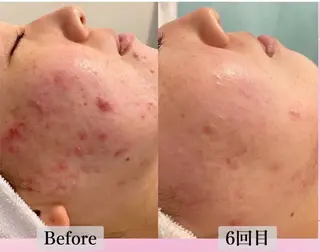 Belle原宿所属・佐藤 加奈のエステ・リラクイメージ