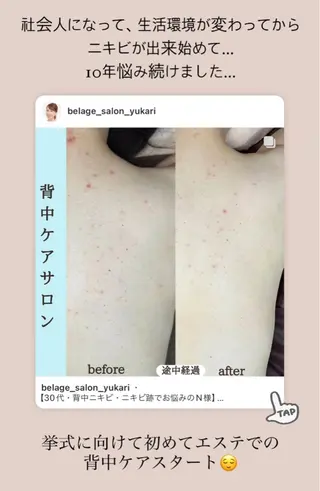 ベラージュ【美背中・ 美尻・フェイシャル】のエステ・リラクイメージ