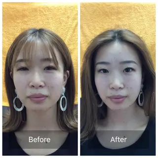 美容鍼・整体 根本改善/小林幸司のエステ・リラクイメージ