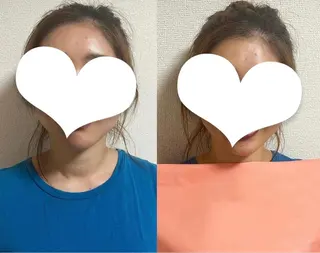 ama  perso nal colorのその他イメージ