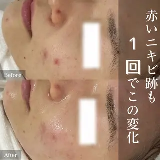 private salon éclat所属・ニキビ・毛穴専門 éclat/エクラのエステ・リラクイメージ