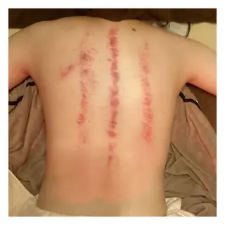 美腸専門 漢方よもぎ蒸しのエステ・リラクイメージ