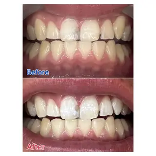 MBEAUTYSALON 千葉店・京成大久保所属・Melty 輝のその他イメージ