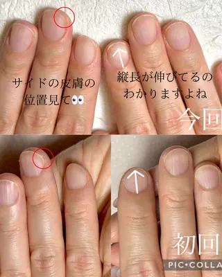 ネイル 深爪・自爪育成専門 MAHALOHIのネイルデザイン