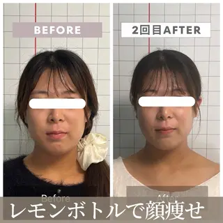 【小顔リフト×小顔矯正専門店】RED所属・猿渡 ひかるのエステ・リラクイメージ