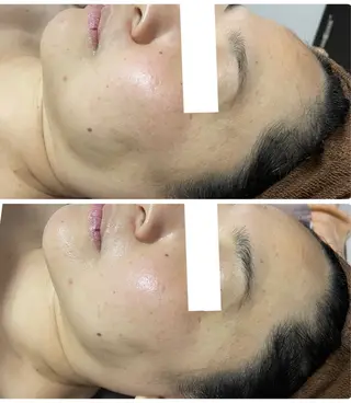 調律エステ /美KISSのその他イメージ