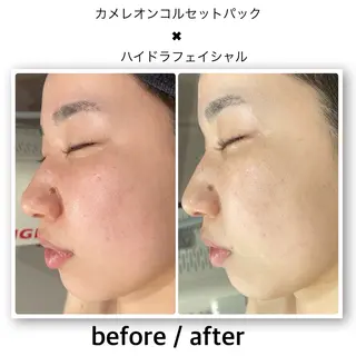 クラスペディア脱毛 ・フェイシャル専門店のエステ・リラクイメージ