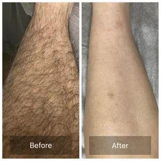 Lumiere despoir所属・Lumiere despoirのエステ・リラクイメージ