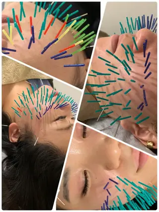 表参道鍼灸院K 美容鍼🔮ララピールのエステ・リラクイメージ