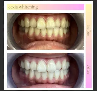 セルフホワイトニング エクシア盛岡中央通店所属・セルフホワイトニング エクシア盛岡あっくんのエステ・リラクイメージ