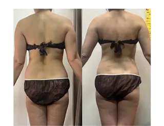 ハイパーナイフ専門店 Salon de COCO所属・Salon de COCOのエステ・リラクイメージ