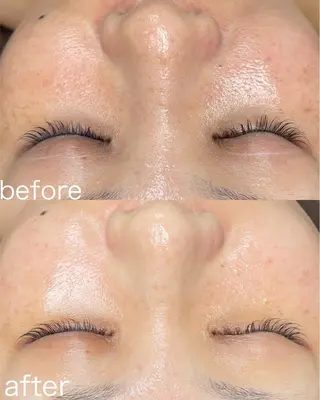 医療提携Beauty SalonMuseのエステ・リラクイメージ