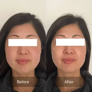 ルコナビューティ所属・小顔・歪み専門　井元 朋子のエステ・リラクイメージ