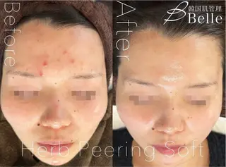 森 Belle目黒のエステ・リラクイメージ