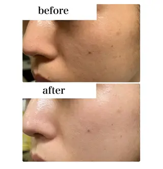 ROR Akariのエステ・リラクイメージ